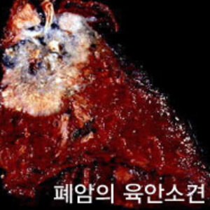 나 금연한지 몇년됐음