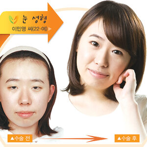 병신짤