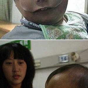 中 ‘철가면’ 쓴채 태어난 아기… 방사능 영향?