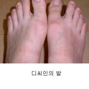 아름다운발